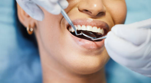 Best Pediatric Emergency Dentist in Byrnes Mill, MO