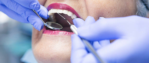 Best Weekend Emergency Dentist in Byrnes Mill, MO