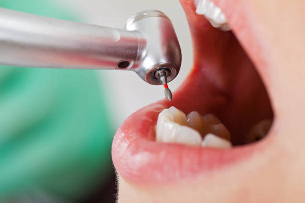 Best Emergency Treatment for Toothache in Byrnes Mill, MO